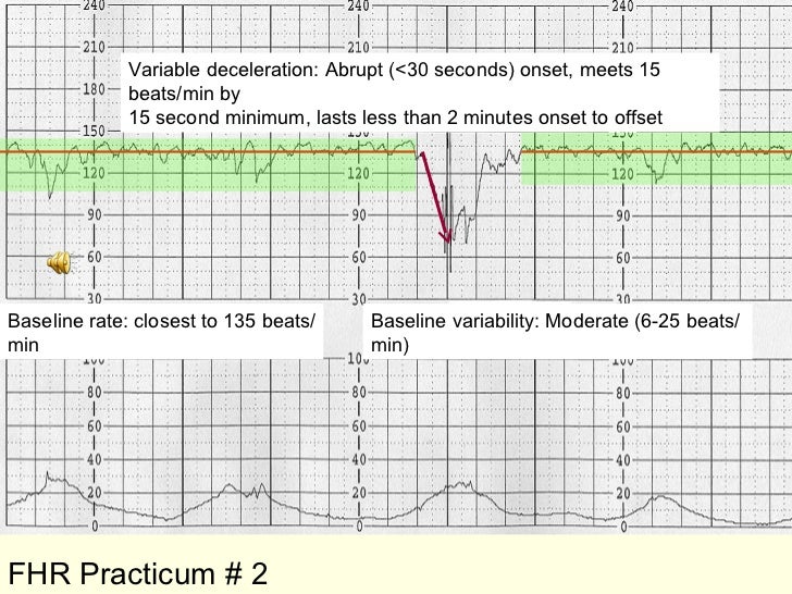 How men mature in society Fetal monitor strip